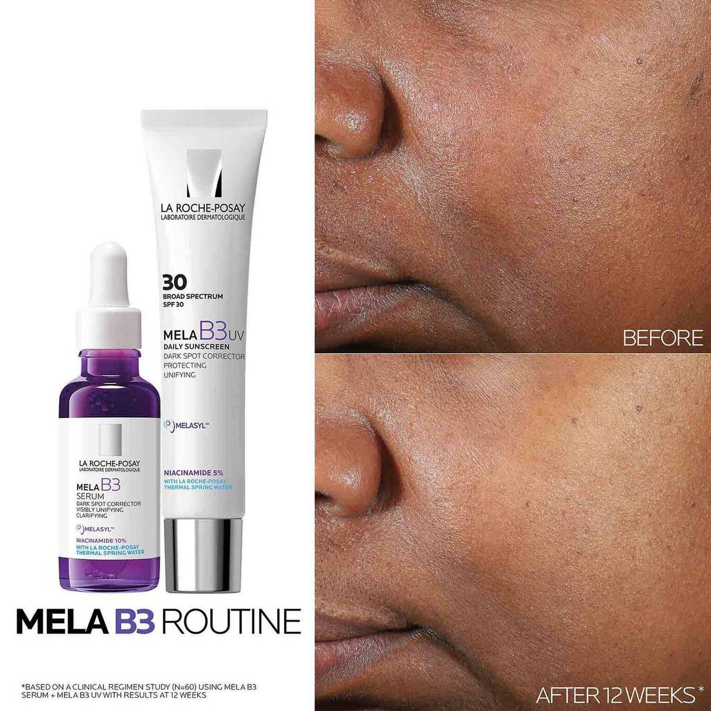 mela-b3-dark-spot-serum-and-mela-b3-uv-daily-moisturizer-with-spf-30-g0 3-Mela-B3-routine_1500X1500.jpg