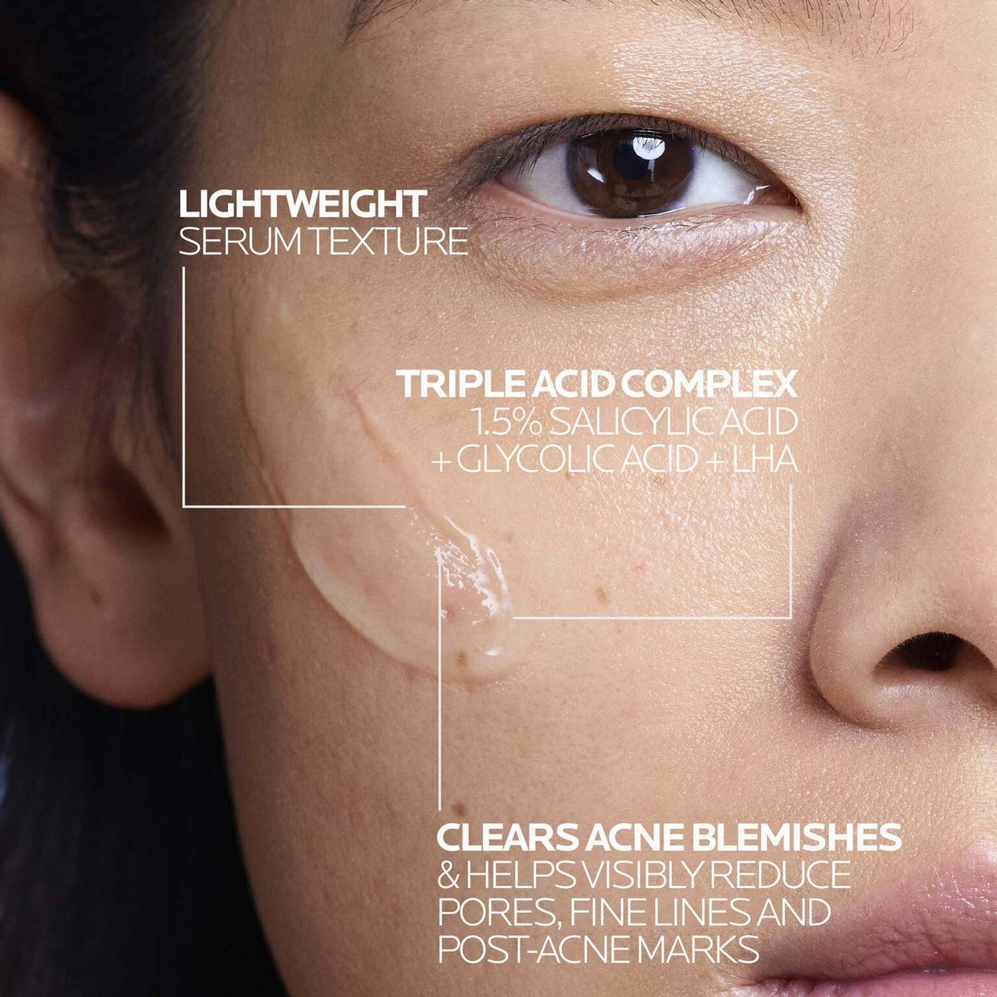 effaclar-salicylic-acid-acne-treatment-serum-u5 LaRochePosay-Product-Effaclar-Effaclar-Serum-30ml-3337875722827-Texture-REV.jpg