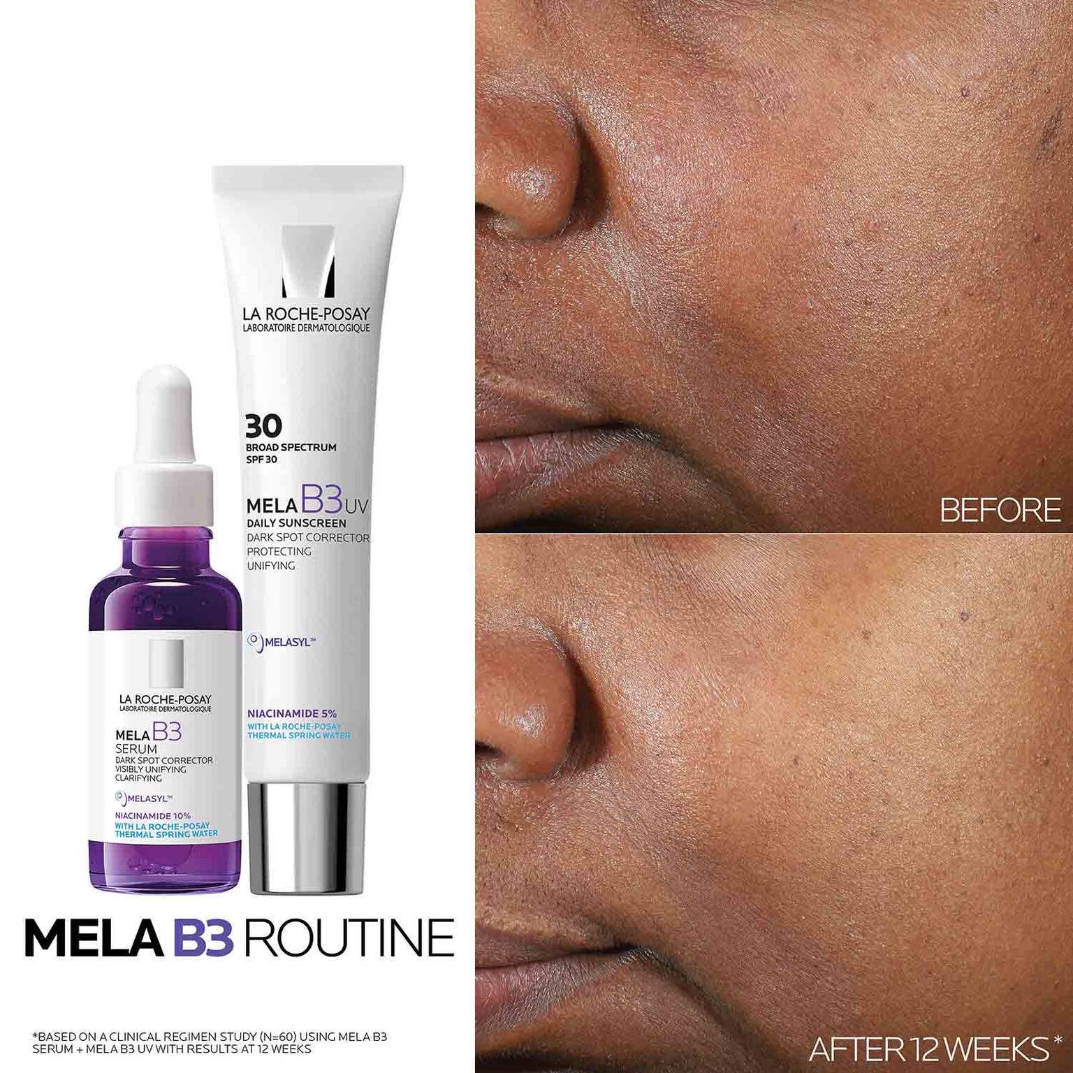 mela-b3-dark-spot-serum-with-melasyltm-niacinamide-x6 Mela-B3-routine_1500X1500.jpg