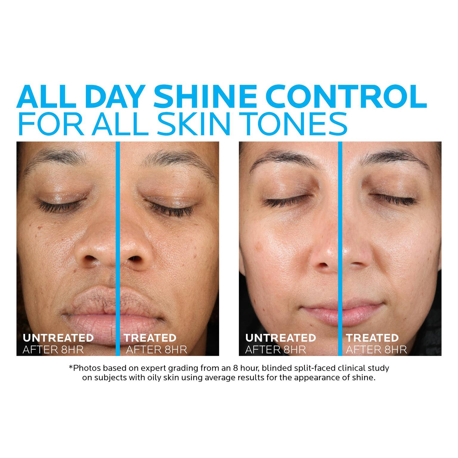 toleriane-double-repair-matte-face-moisturizer-for-oily-skin-f8 la-roche-posay-toleriane-matte-moisturizer-before-and-after-pdp-alt.jpg